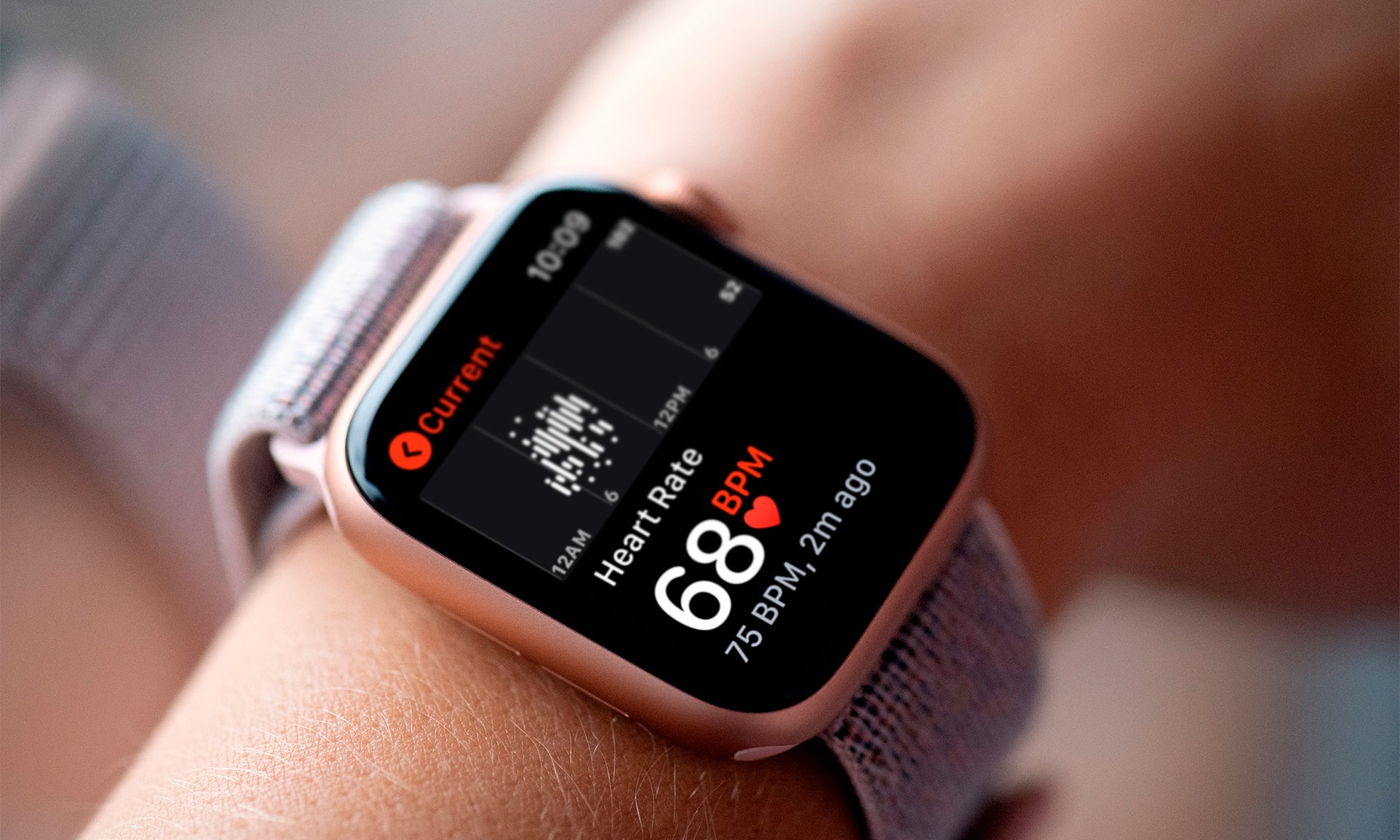 Qua nhieu nguoi den benh vien vi Apple Watch hinh anh