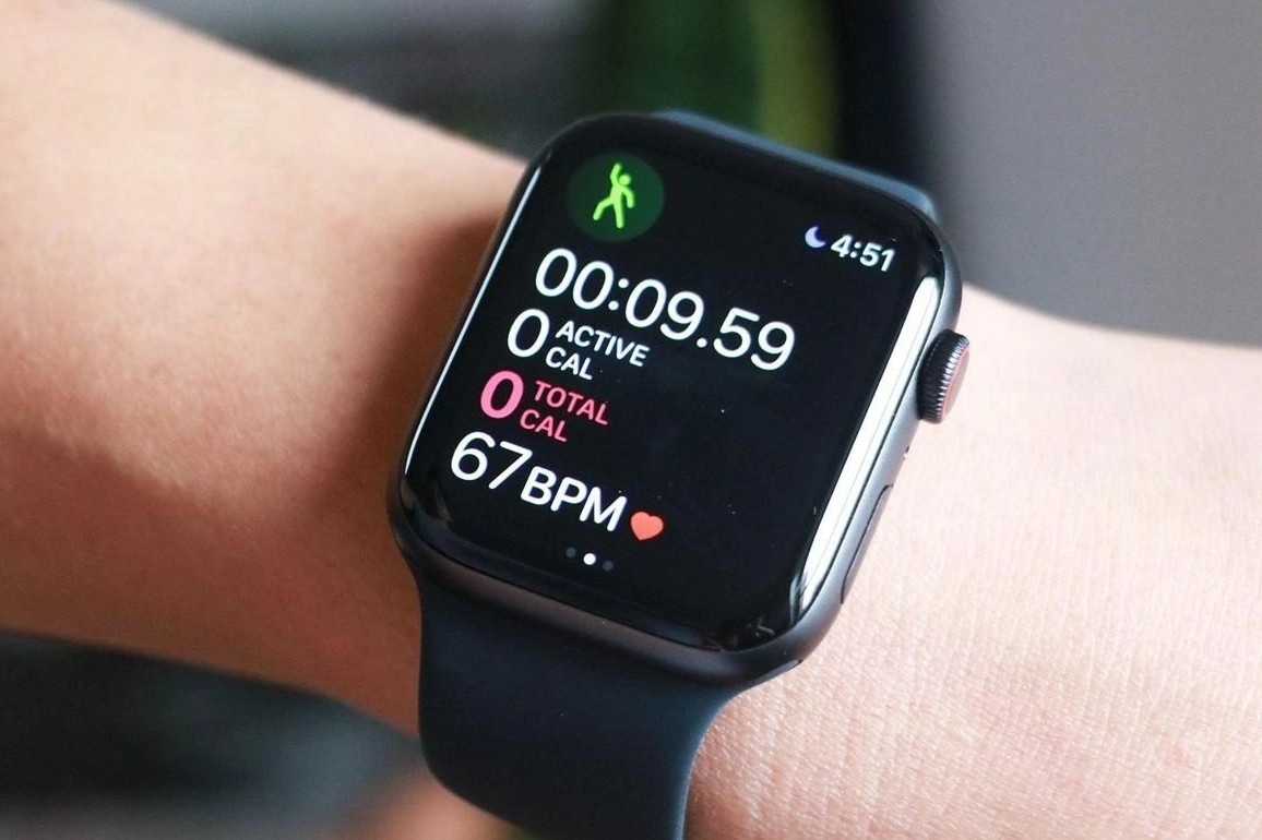 Apple Watch sap co thay doi lon hinh anh
