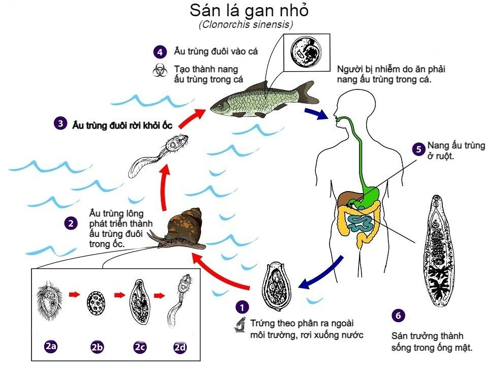 san la gan,  ky sinh trung,  benh vien Tam Anh,  Tam Anh anh 3