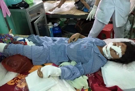 Nguoi cat gan tay, gan chan vo ra dau thu hinh anh