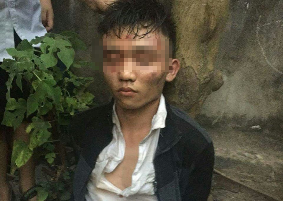 Dan vay bat nghi pham dam nu chu quan tap hoa de cuop hinh anh