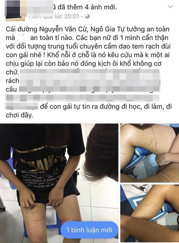 Thieu nu 14 tuoi trinh bao bi rach dui anh 1