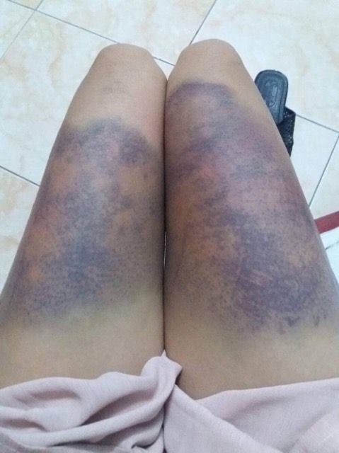 cô gái tố bạn trai đánh đập ảnh 1 co gai to ban trai danh dap anh 1