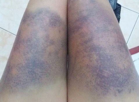 Thanh nien danh ban gai bam tim khap nguoi do ghen hinh anh