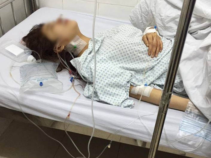 Nu chu quan bi chong dam guc tai hang an dem vi ghen hinh anh