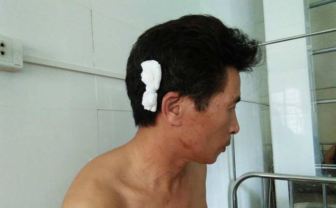 Thanh nien tan cong ca nha nguoi phu nu di bo sau va cham giao thong hinh anh