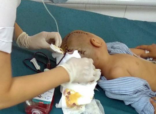 Cong an dieu tra vu be trai tu mau nao do nga o truong mam non hinh anh