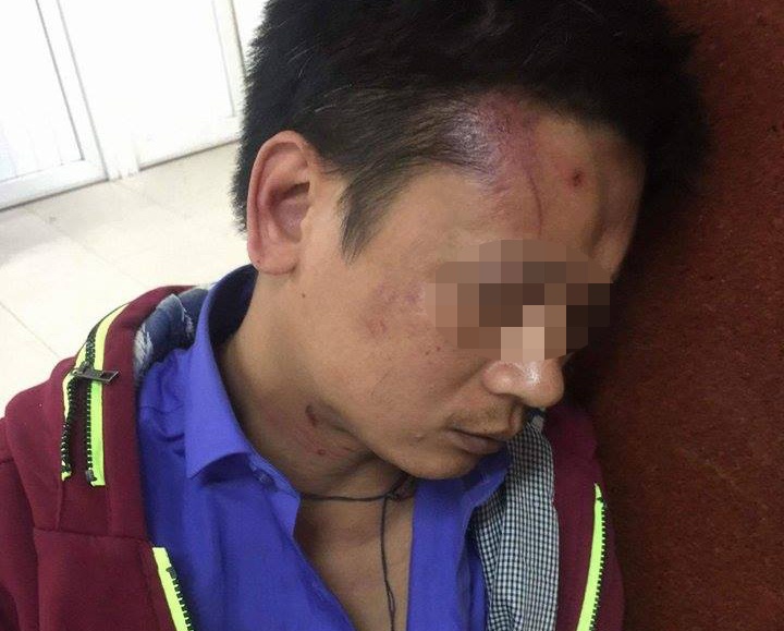 Tai xe oto to bi bao ve benh vien hanh hung hinh anh