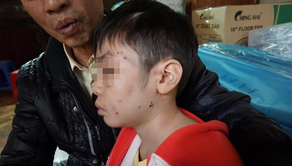 Phut tron chay khoi nha cua be 10 tuoi 'to' bi bo bao hanh hinh anh