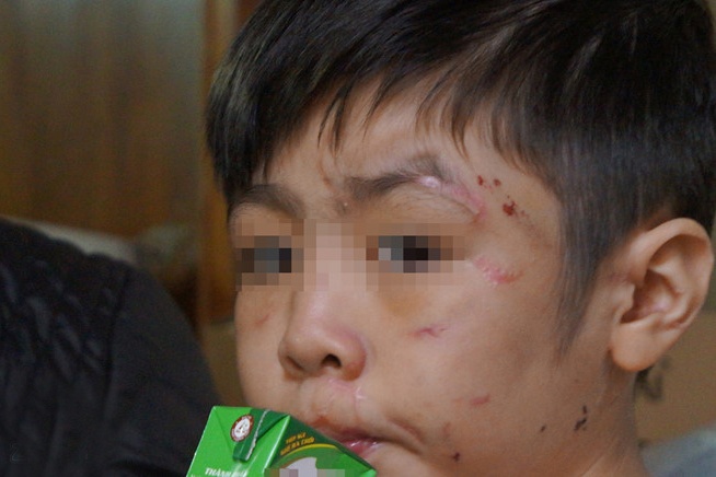 Bố đẻ hành hạ con ruột ở Hà Nội ảnh 2 Bo de hanh ha con ruot o Ha Noi anh 2