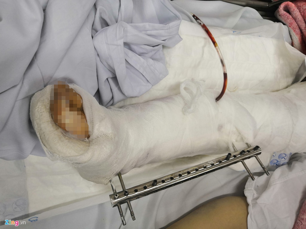 Lexus dam hang loat xe may anh 2