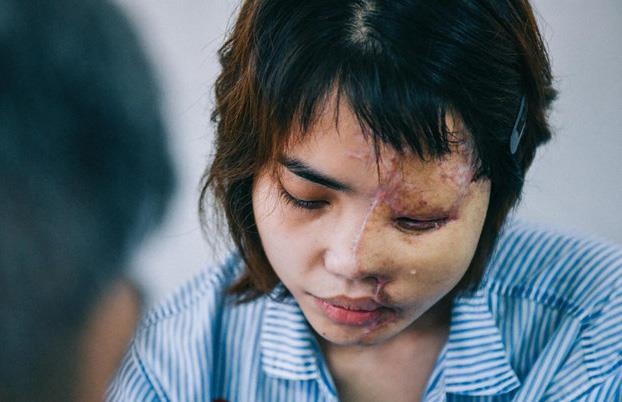 Những vụ tạt axit ảnh 1 Nhung vu tat axit anh 1