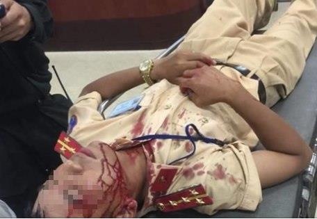 Dai uy CSGT bi nguoi vi pham luat dung da danh nhap vien hinh anh