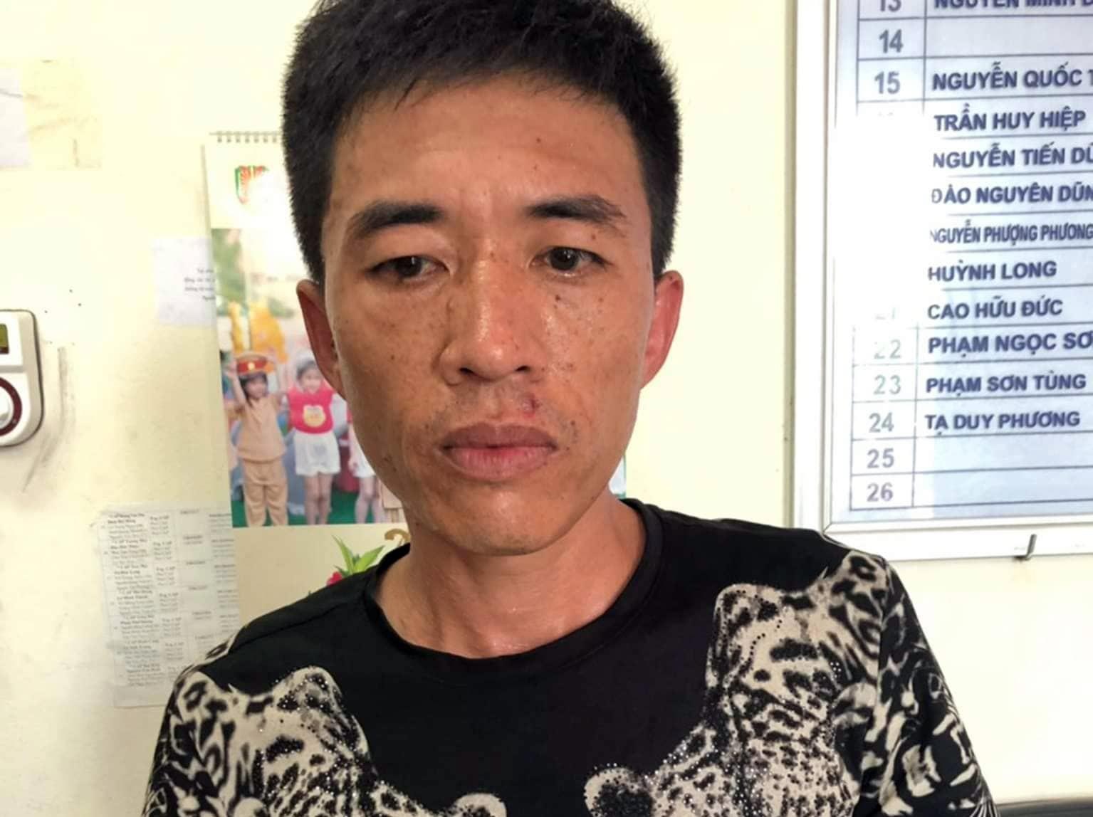 Ke khong che ban gai, ban canh sat trong thuong khai gi? hinh anh