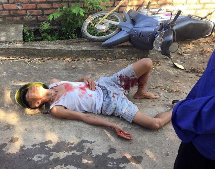 Cong an bac tin 'CSGT truy duoi lam nguoi dan ong nga nhap vien' hinh anh