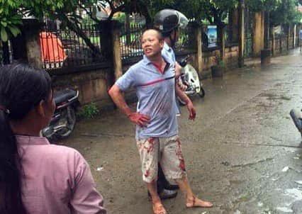 Nhan chung ke phut hung thu truy sat ca gia dinh em trai hinh anh