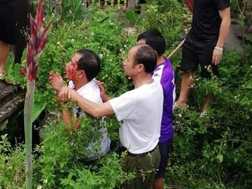 Ke nghi bat coc be gai 7 tuoi co tien an hiep dam hinh anh