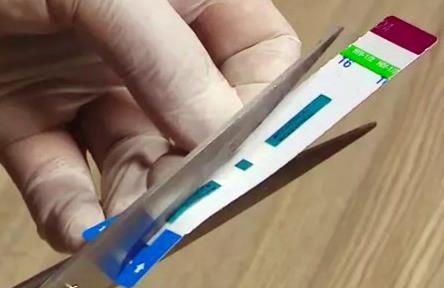 Vu cat doi que thu HIV, viem gan B se xu ly ra sao? hinh anh