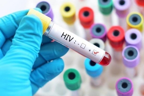 Dieu tra vu cat doi que thu HIV, viem gan B o Xanh Pon hinh anh