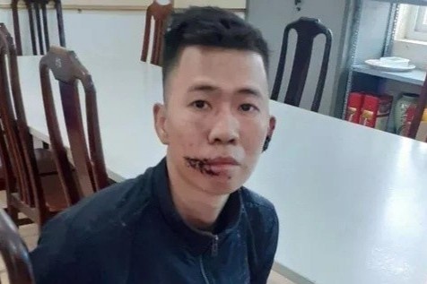 Bat nghi pham giet me, chem cha bi thuong hinh anh