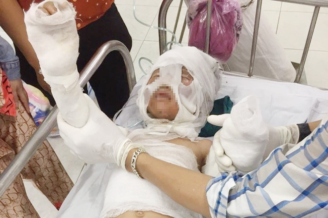 Di tuoi xang dot chau anh 1