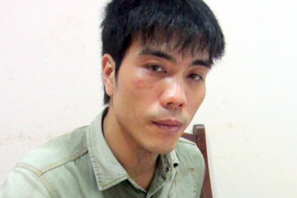 Trum tin dung den trinh ho so benh an tam than hinh anh