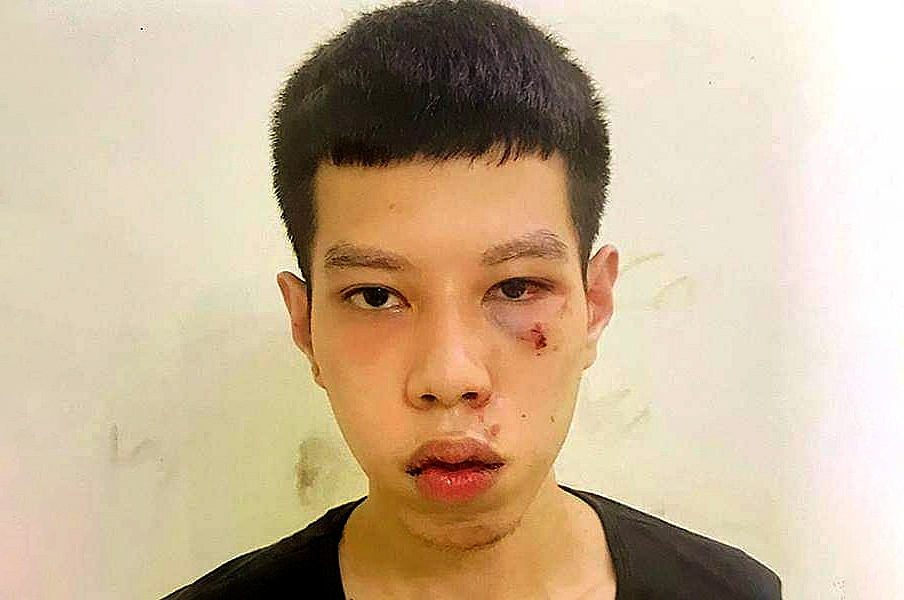 Anh em sinh doi lien quan vu cuop ven ho Tay hinh anh