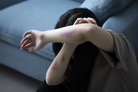 Be 1 tuoi o TP.HCM bi bao hanh tu vong hinh anh