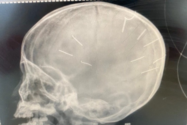 Dong dinh vao dau anh 1