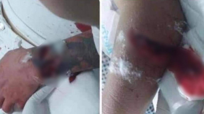 Ly do khien thanh nien chem bo va cau cua ban gai trong ngay ra mat hinh anh