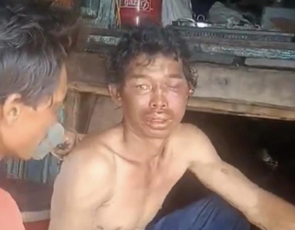 Hành hạ trên tàu cá ảnh 1 Hanh ha tren tau ca anh 1