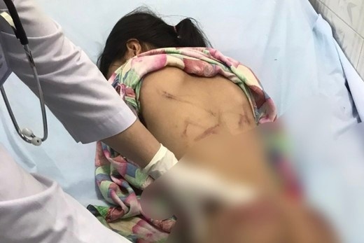 Dieu tra vu be gai nghi bi bao hanh khi o voi co ho hinh anh
