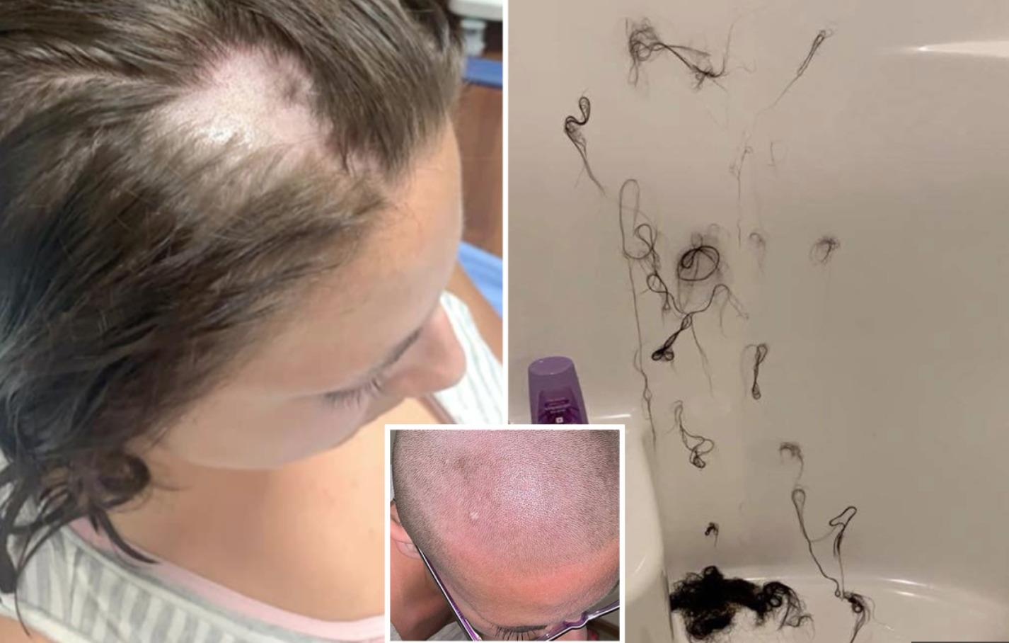 Co gai My cao troc dau sau khi dung dau xa gia anh 1