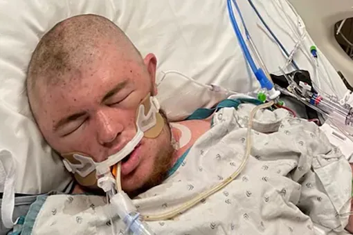 Thanh nien My hon me sau khi bi ong sat thu dot 20.000 lan hinh anh