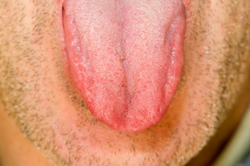 Nguoi phu nu Phap can dut luoi nghi pham hiep dam de lam bang chung hinh anh