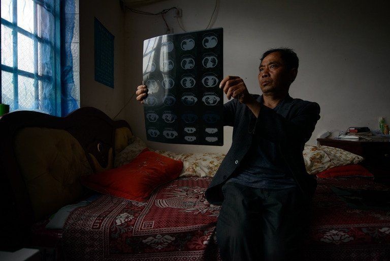 cong nhan than benh bui phoi anh 5