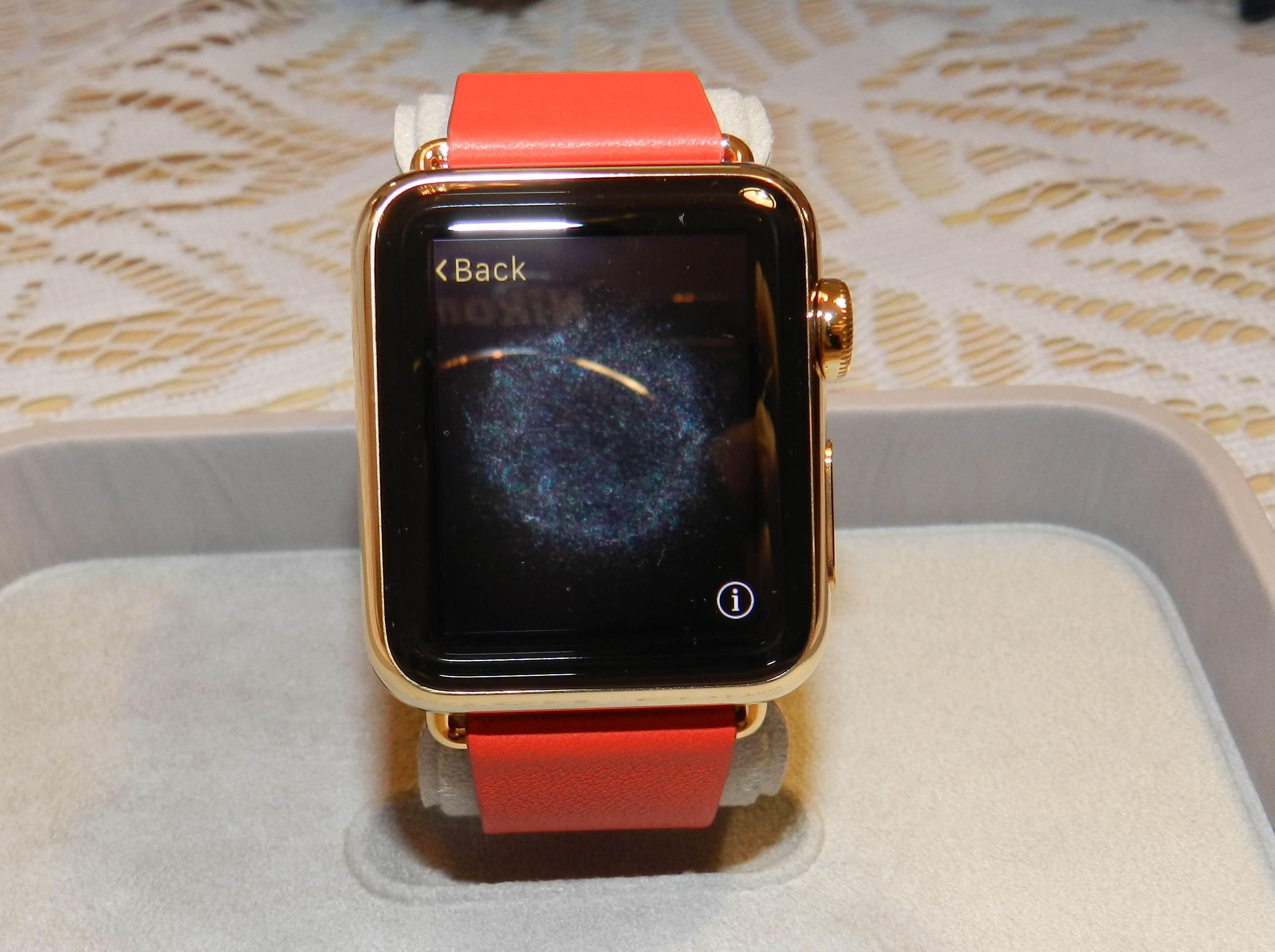 IDC: Apple bi Xiaomi qua mat o thi truong thiet bi deo tay hinh anh