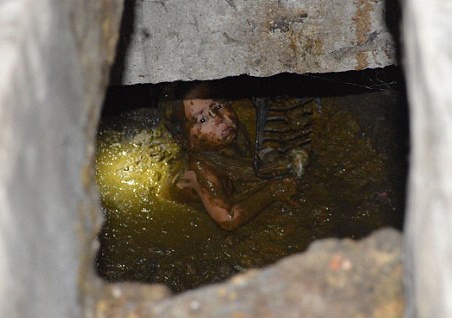 Be 20 thang tuoi roi xuong ho chat thai hinh anh