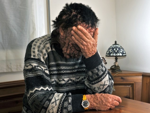 Can benh quai ac hanh ha ‘nguoi mat quy’ hinh anh