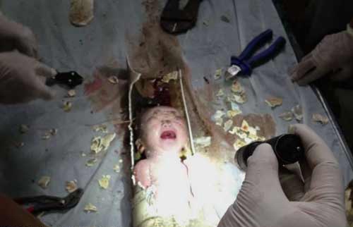 Nhung be so sinh song sot ky dieu nhat nam hinh anh