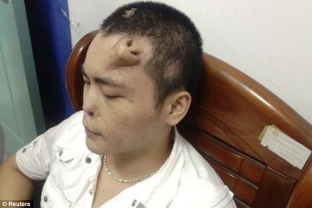 Nhung ca phau thuat cay ghep ky la nhat nam 2013 hinh anh