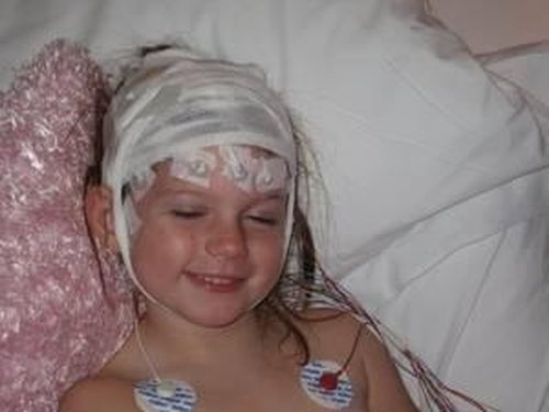 5 ca phau thuat ky dieu noi tieng the gioi hinh anh