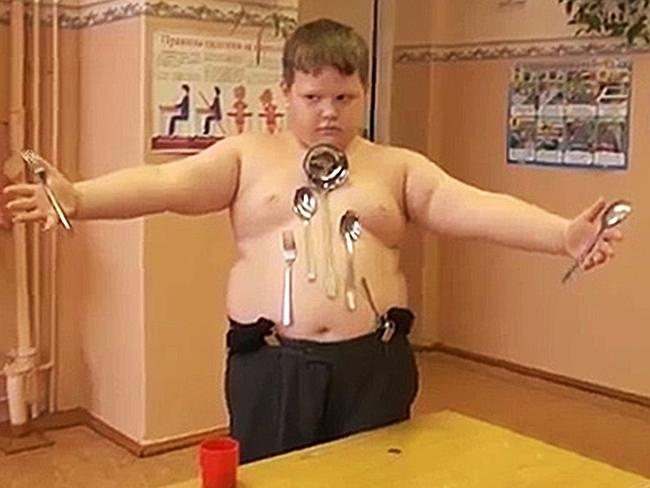 Nam sinh co kha nang hut vat kim loai sau tai nan dien giat hinh anh