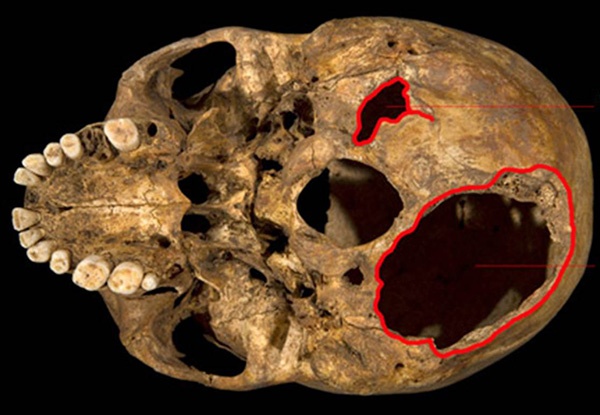 ADN giai ma cai chet tham khoc cua 'ong Vua gu' nuoc Anh hinh anh