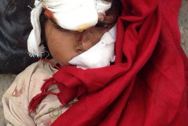 Nan nhan la khoc vi dau don sau tham hoa dong dat Nepal hinh anh