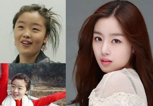 sao han phau thuat tham my anh 4