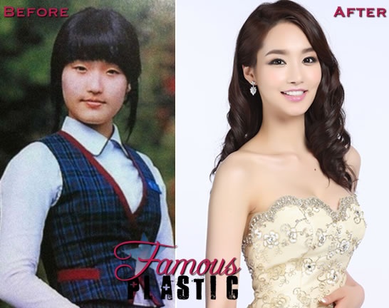 sao han phau thuat tham my anh 5