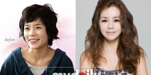 sao han phau thuat tham my anh 6