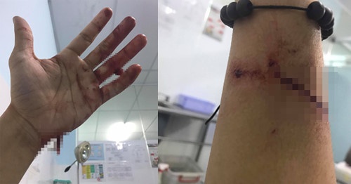 Dong Hung tra no anh 1