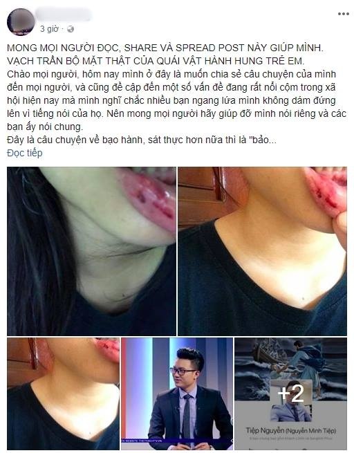 BTV VTV bi to danh em vo anh 1